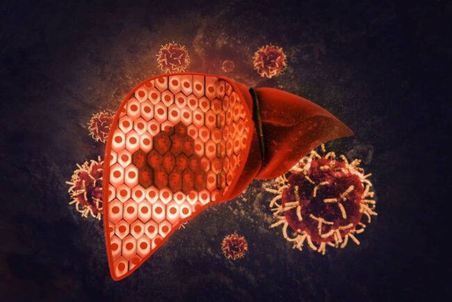 Choroby wątroby u psa