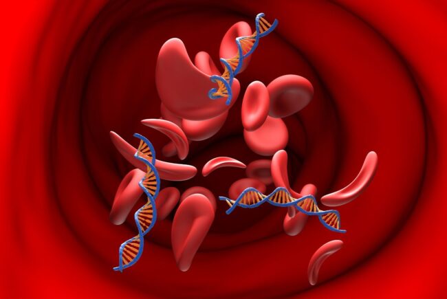 Anemia u psa